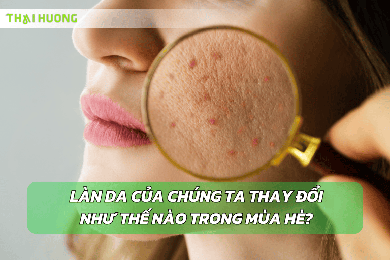Da nhạy cảm với tia UV và dễ mất nước hơn trong mùa hè